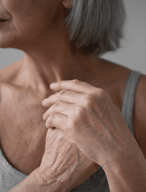 costo-de-tratamiento-para-osteoporosis-en-veracruz.png